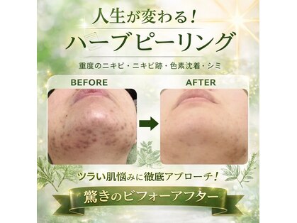 マリアージュ ビューティ 銀座(Mariage Beauty)の写真