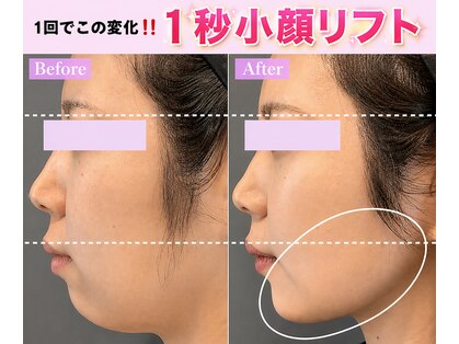 カンナムビューティー 新宿 代々木の写真