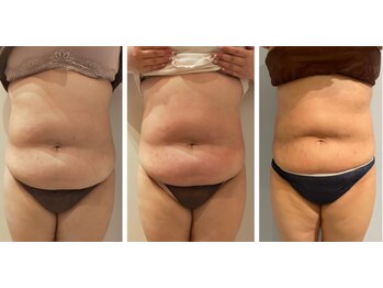 ルナグランデ(Luna grande.)/結果が見えると嬉しいですよね!