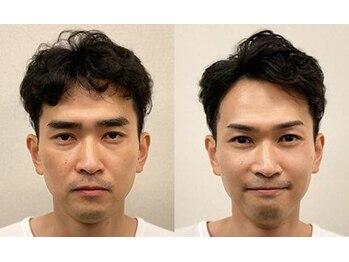 ファースト 新宿本店/自然/平行/アーチ/角眉/新宿