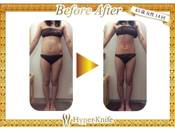 レディ 橋本/美ボディ♪