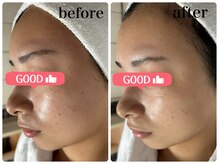 ニュウ(Nyu)/ララピール