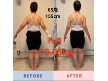 ナチュールフィット(Natur Fit)/65歳　ビフォーアフター