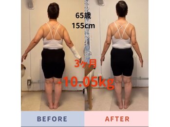 ナチュールフィット(Natur Fit)/65歳　ビフォーアフター