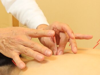 エグボッグ 恵比寿(EGBOK)の写真/鍼灸が初めての方こそオススメ☆首肩こり/腰痛/不調改善◎鍼灸で身体の変化を実感♪鍼灸×美容鍼も大人気！
