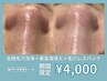 【本日限定ゲリラクーポン☆】全顔ハイドラフェイシャル毛穴洗浄で"即"解消◎