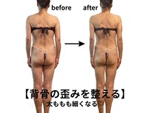 ピオニービューティー(Peony Beauty)/背中の歪みを整える！