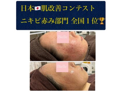 ビエル(Bielle)の写真