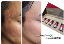 癒しサロン リバース