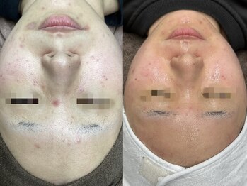 マルサンカクシカク(○△□)/