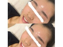 ラ フルール(La Fleur)/ハリウッドブロウリフト