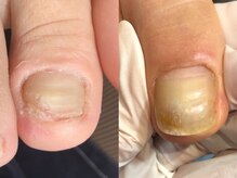 サロン ルーシュ(salon ruche)/フット育成