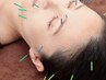 人気No.1★【リフトアップ】老け顔&たるみ改善/痛み極少！極細美容鍼¥5,000