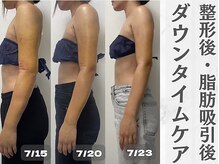 トレス(Tres)の雰囲気（インディバ【最上位機種ER200】美容施術後の回復スピードUP！！）