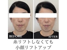 クロア 名古屋 覚王山店(croire)の雰囲気（小顔矯正と肌管理の同時施術が一番人気です☆名古屋）