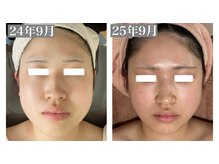 効果が持続し、元に戻らない施術◎理想の自分に近づける！