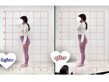 1度の施術でもしっかり効果！痩せた？って言われます！！