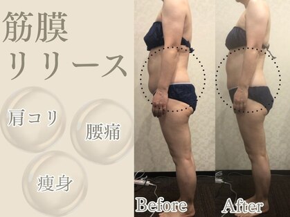 ポポのエステ(popoのエステ)の写真