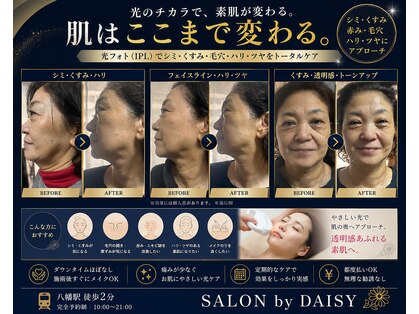 サロン バイ デイジー(SALON by DAISY)の写真