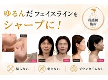 エン 橿原店(en)の雰囲気（フェイスラインのゆるみやたるみに、脂肪×筋肉からアプローチ）