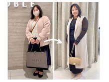 エピファニー 東京 銀座/ビフォーアフター（M.Y様 30代）