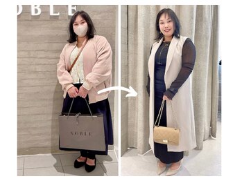 エピファニー 東京 銀座/ビフォーアフター(M.Y様 30代)