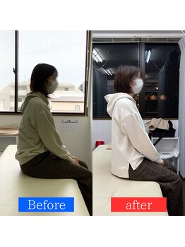 ナオル整体 神戸住吉院(NAORU整体)/20代女性【猫背】