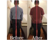 カワル整体 上通り院/首と肩が痛くて夜眠れません…