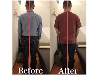 カワル整体 上通り院/首と肩が痛くて夜眠れません…