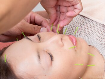 ハリスル 神戸訪問鍼灸付属治療院(harisuru)/鈴蘭台に本格美容鍼(^^)