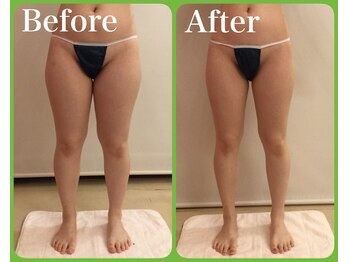 トータルビューティサロン クイーン(Queen)/●美脚へお任せ下さい●