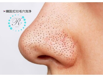 ラデュープラス(Radieux+)の写真
