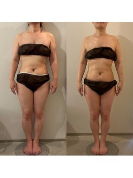 ラナ 京都西院店(Lana)/夏に向けて全身デトックス！