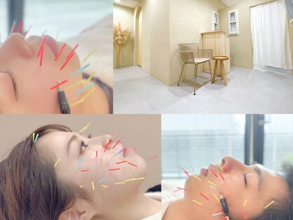 ミー(Mi)の写真