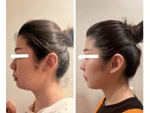 ヨサパーク チアリ(YOSA PARK Tiari)の雰囲気（二重顎・絶壁・たるみ・余白etc お顔のお悩みもお任せください。）