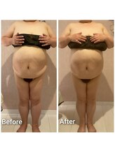 エミア(Emia)/全身痩せ×歪み改善◎120分 １回