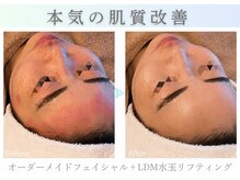 アマテラススキンラウンジ(Amatelas SKIN LOUNGE)の雰囲気（本気の肌質改善！お客様1人1人に合わせたオーダーメイド施術を。）