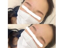 ラ フルール(La Fleur)/ハリウッドブロウリフト