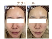 ティアム バイ テトテ 神戸三宮(TIAM by tetote)/ララピール