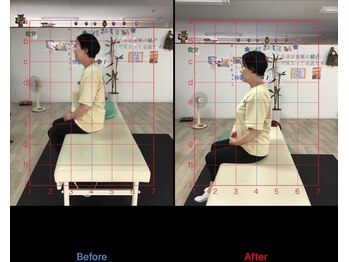 ストレチックス 近江八幡店/ストレッチ ビフォーアフター