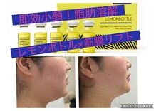 ジェミー(Gemmy)