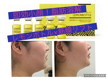 ジェミー(Gemmy)の写真