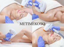 ミータイムコト(METIMEKOTO)