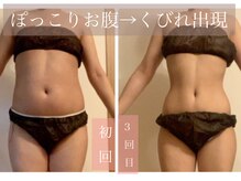 【痩身★】脂肪撃退！全身隅々オールハンドリンパドレナージュ♪