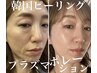 毛穴しみたるみ改善☆ピーリング×プラズマ×高濃度30%エクソソーム導入1回