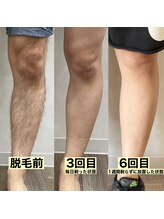 セルフメイド サンリブしみず店(SELFMADE)/メンズ脚のビフォー&アフター