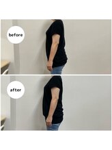 糸満メディカル整体/腰痛の原因になる反り腰改善