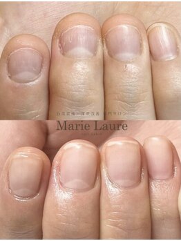 マリーロール 天王寺店(Marie Laure)/自爪育成/深爪矯正/ネイルケア