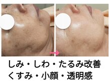 庭夢エステ