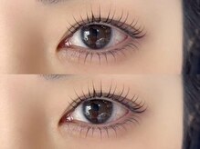 アイプラスサンテ (eye+sante)